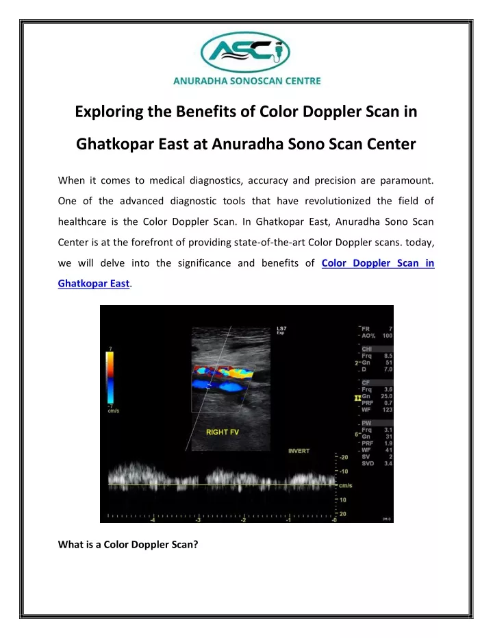 exploring the benefits of color doppler scan in