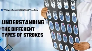 Understanding  the Different Types of Strokes