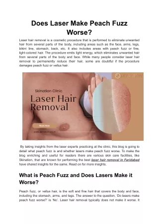 Does Laser Make Peach Fuzz Worse