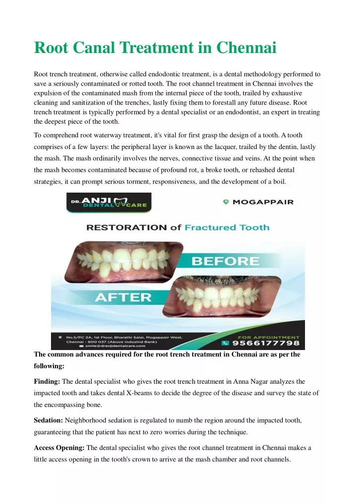 root canal treatment in chennai root trench