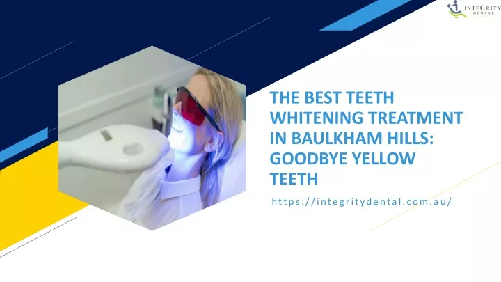 the best teeth whitening treatment in baulkham hills goodbye yellow teeth