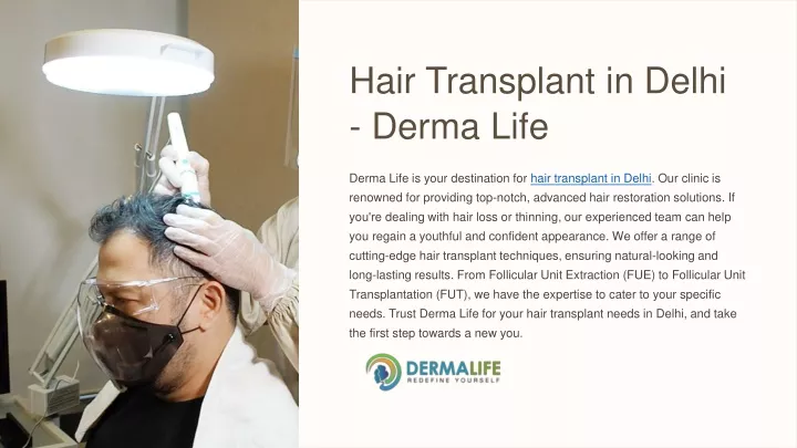 hair transplant in delhi derma life