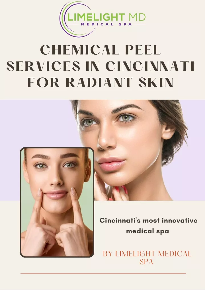 chemical peel services in cincinnati for radiant