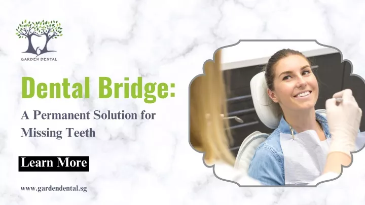 dental bridge