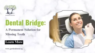 Dental Bridge A Permanent Solution for Missing Teeth