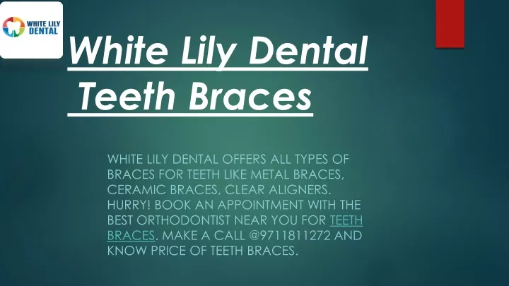 white lily dental teeth braces