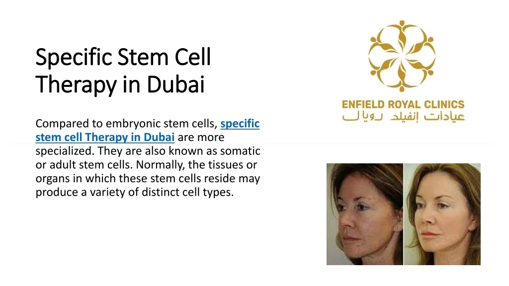 PPT - specific stem cell therapy PowerPoint Presentation, free download ...