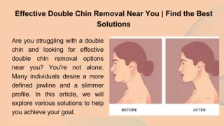 Effective Double Chin Removal Near You | Find the Best Solutions