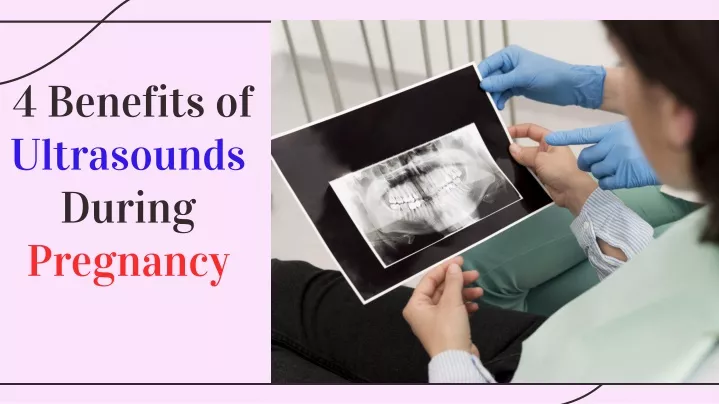 4 benefits of ultrasounds during pregnancy