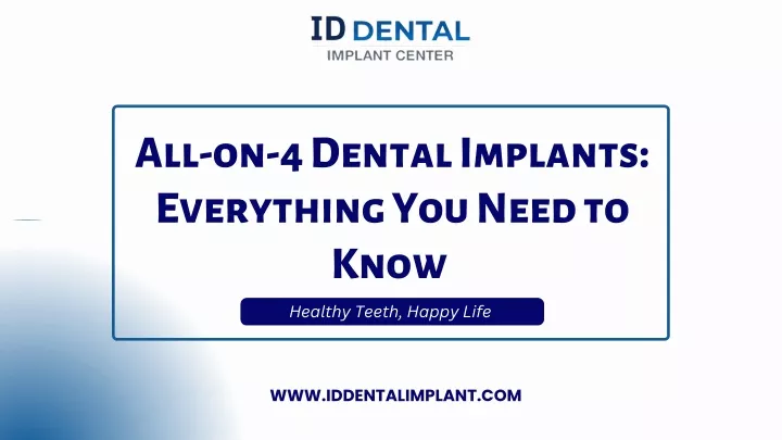 all on 4 dental implants everything you need