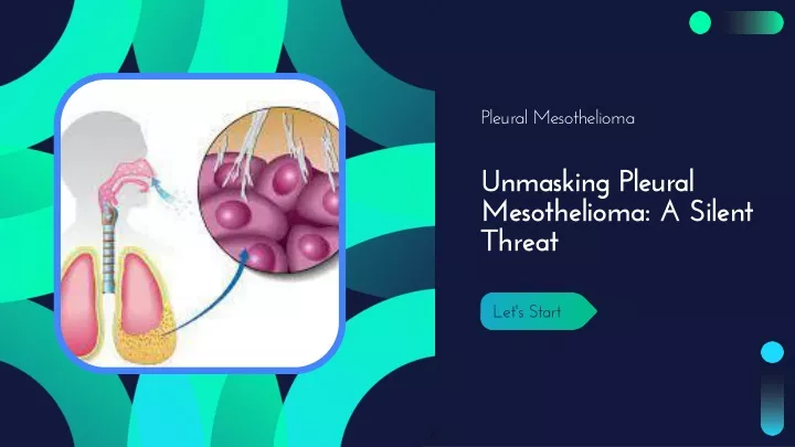 pleural mesothelioma