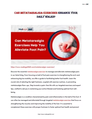 Can Metatarsalgia Exercises Enhance Your Daily Walks?