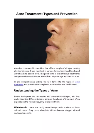 Acne Treatment: Types and Prevention