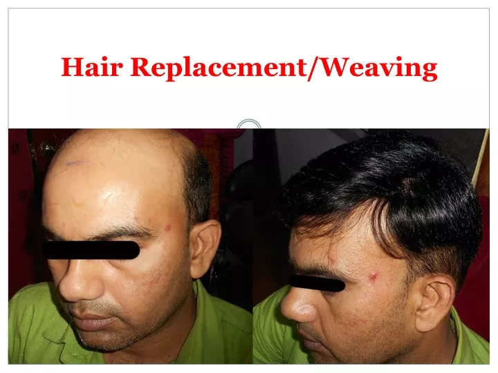 hair replacement weaving