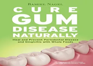 (PDF) Cure Gum Disease Naturally: Heal and Prevent Periodontal Disease and Gingi