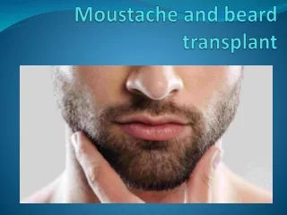 moustache and beard transplant