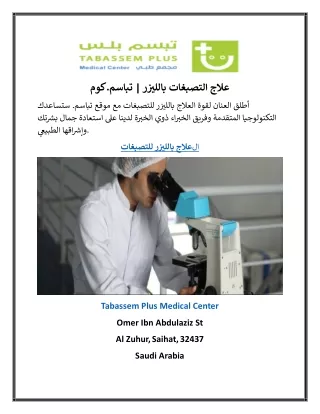 علاج التصبغات بالليزر