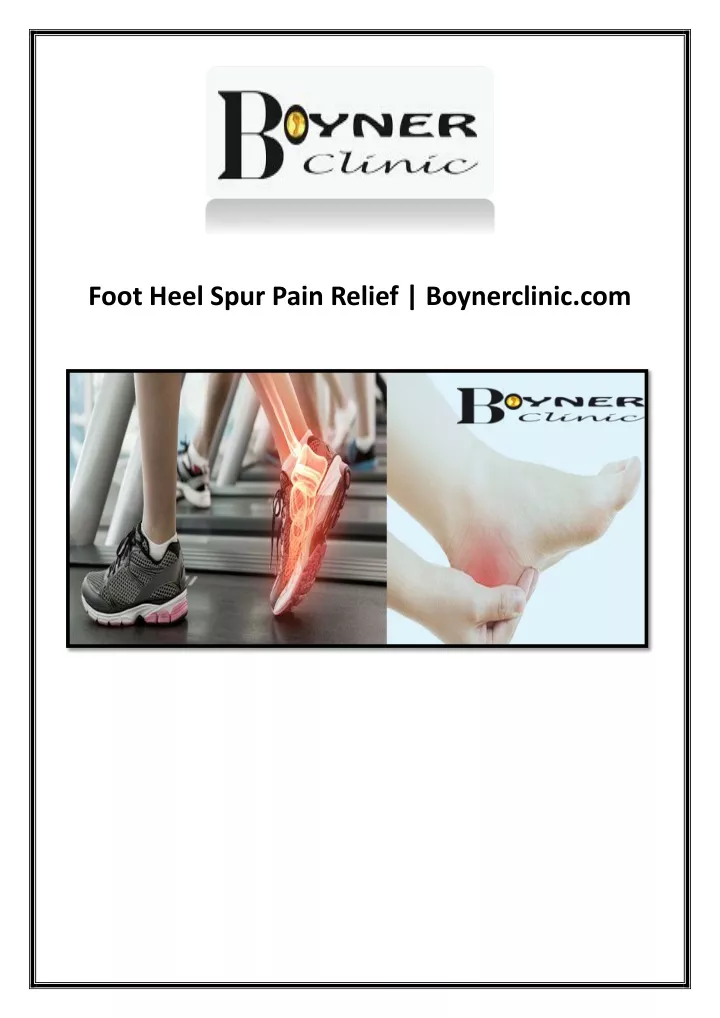 foot heel spur pain relief boynerclinic com