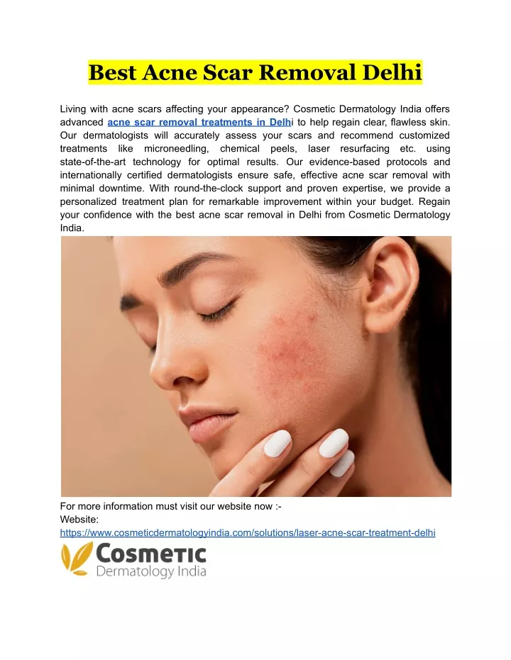best acne scar removal delhi
