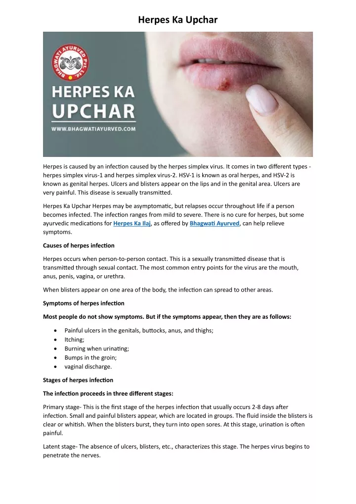 herpes ka upchar