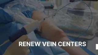 Laser Spider Vein Treatment In Nanuet Ny | Renewveincenters.com