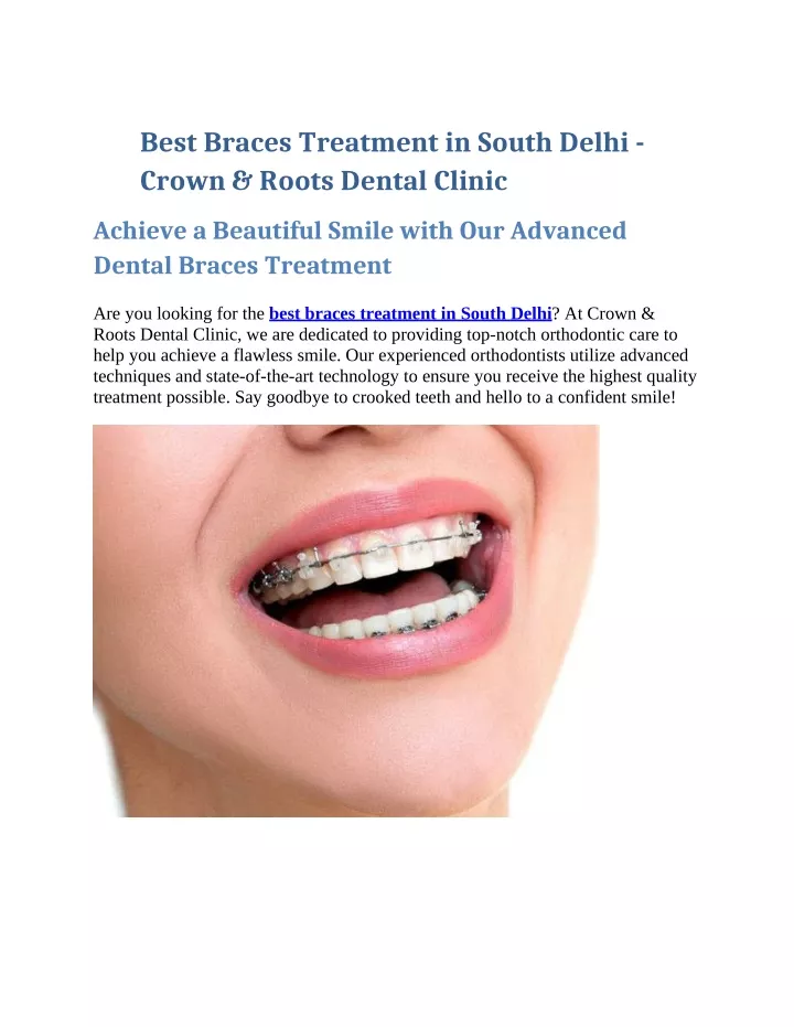 best braces treatment in south delhi crown roots