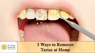 3 Ways to Remove Tartar at Home