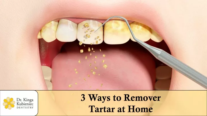3 ways to remover tartar at home