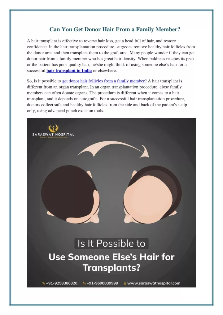 can you get donor hair from a family member