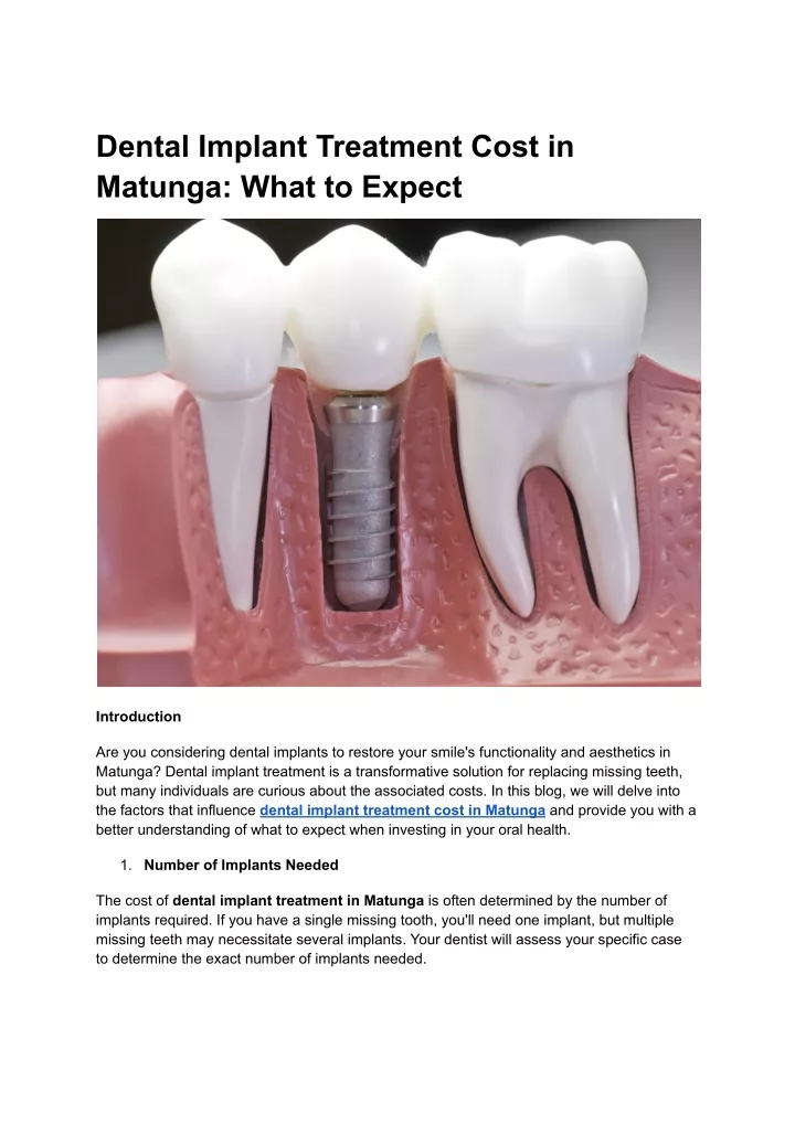 dental implant treatment cost in matunga what