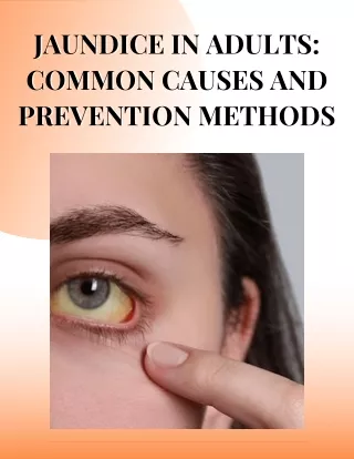 Jaundice in Adults Common Causes and Prevention Methods