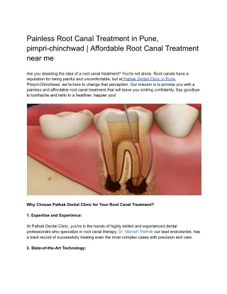 Painless Root Canal Treatment in Pune, pimpri-chinchwad _ Affordable Root Canal Treatment near me
