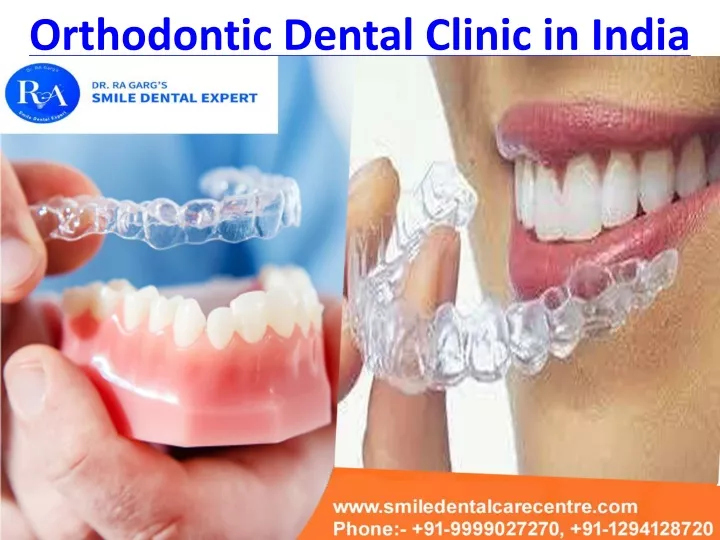 orthodontic dental clinic in india