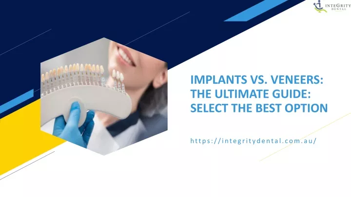 implants vs veneers the ultimate guide select the best option