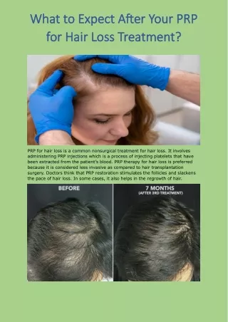 What To Expect After Your Prp For Hair Loss Treatment