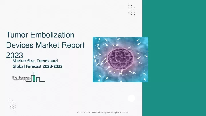 tumor embolization devices market report 2023