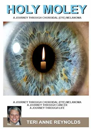 EPUB DOWNLOAD Holy Moley: A Journey Through Choroidal (Eye) Melanoma ipad