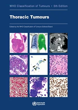 PDF KINDLE DOWNLOAD Thoracic Tumours: WHO Classification of Tumours android