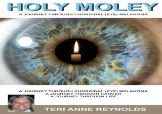 PDF Holy Moley: A Journey Through Choroidal (Eye) Melanoma Free