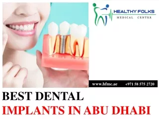 BEST DENTAL IMPLANTS IN ABU DHABI pdf