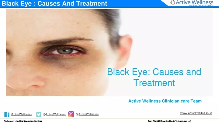 black eye causes and treatment