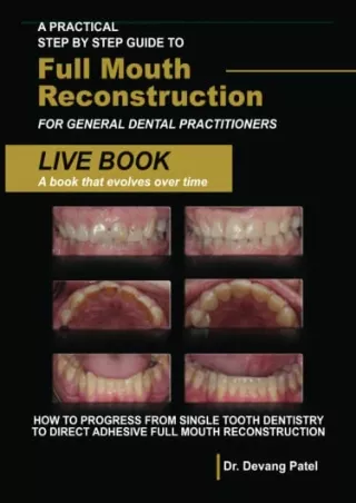 PDF A Practical Step By Step Guide to Full Mouth Reconstruction for General