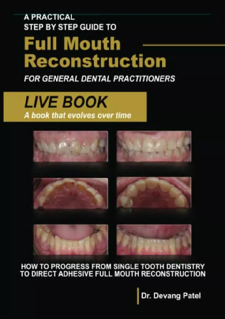 a practical step by step guide to full mouth