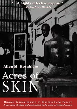 DOWNLOAD [PDF] Acres of Skin: Human Experiments at Holmesburg Prison ipad