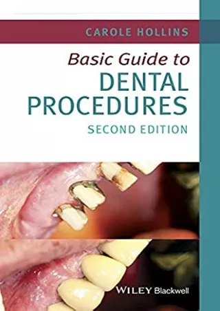 READ/DOWNLOAD Basic Guide to Dental Procedures (Basic Guide Dentistry Serie