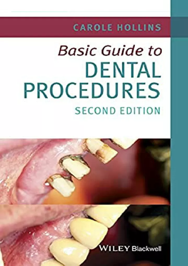 basic guide to dental procedures basic guide