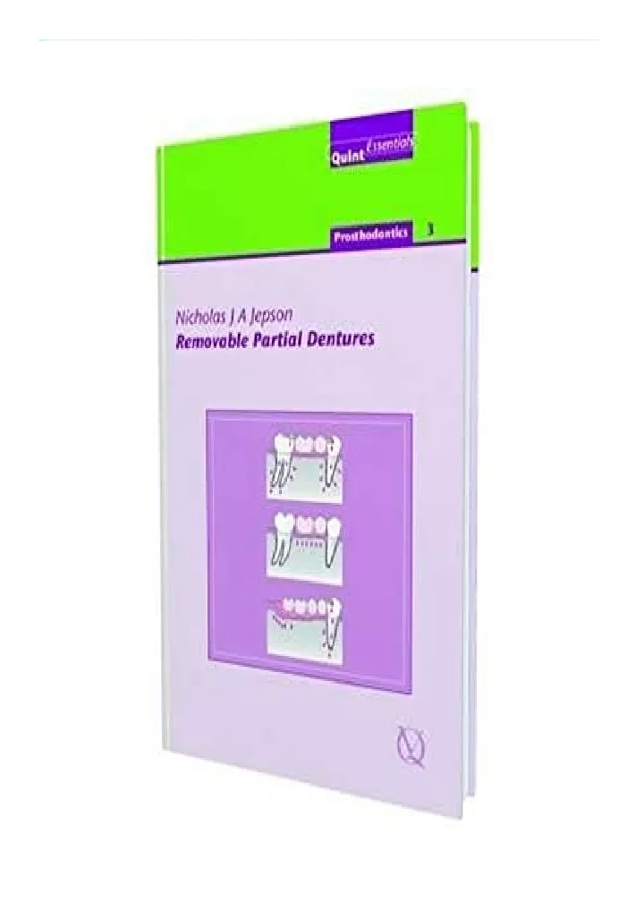 removable partial dentures prosthodontics