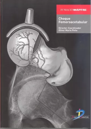 PDF Download Choque femoroacetabular (Spanish Edition) full