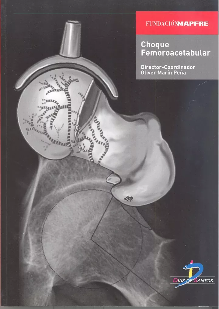 choque femoroacetabular spanish edition download