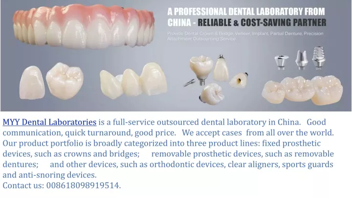 myy dental laboratories is a full service